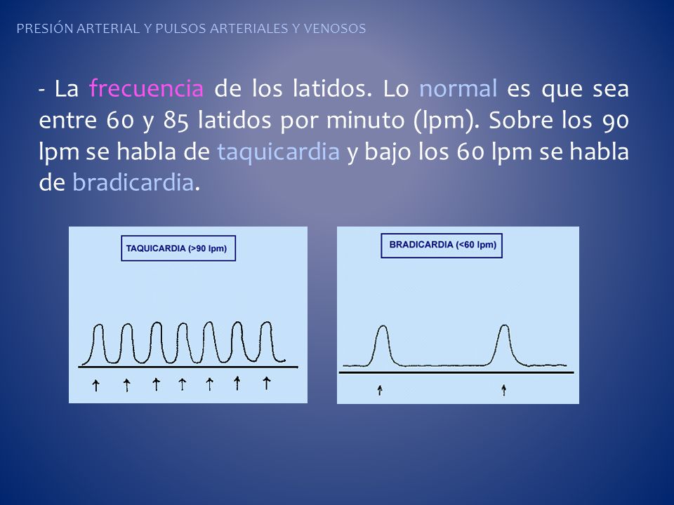 Presión arterial alta cuando el pulso es bajo Presión arterial alta cuando el pulso es bajo